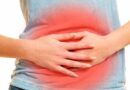 Colitis